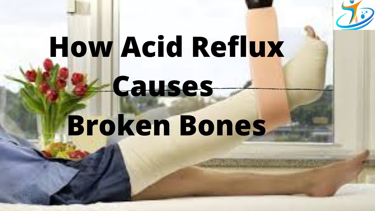 How Acid Reflux Causes Broken Bones YouTube