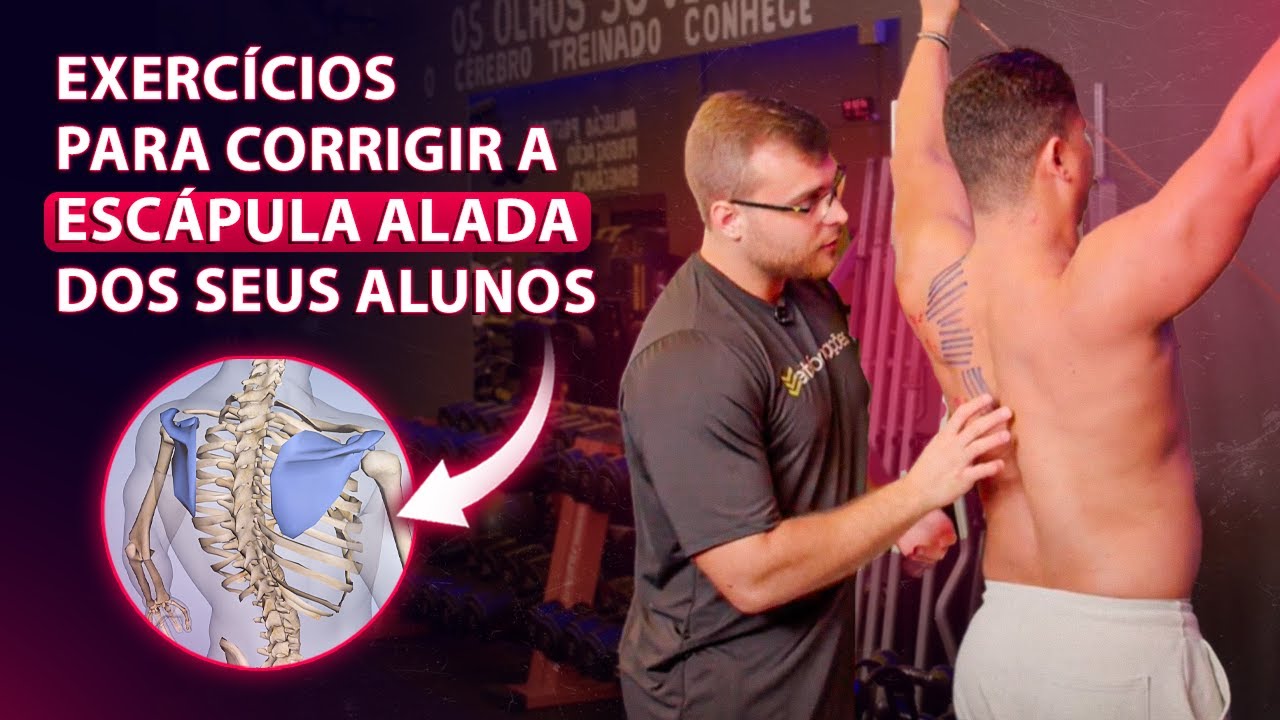 TUDO QUE UM PERSONAL TRAINER PRECISA SABER SOBRE ESCÁPULA ALADA | João Franken