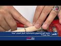 تقرير | جمعية النور للمكفوفين تختتم فعاليات المركز الصيفي "صيفنا عطاء ونماء 11".