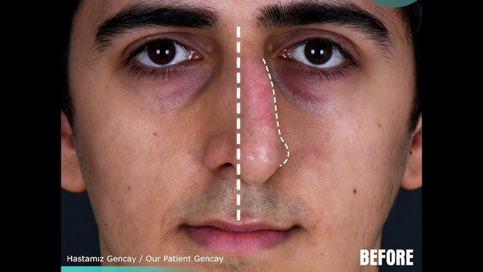 Yalangoch qiz va prezervativ