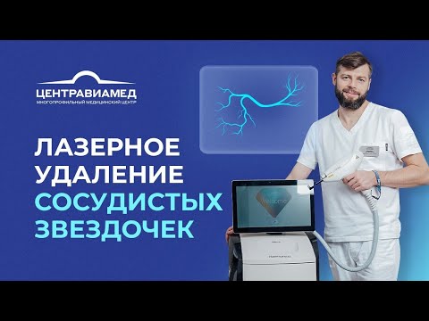 Лазерное удаление сосудистых звездочек