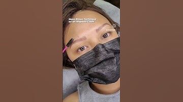 Alopecia Brows Transformation done by Tho Brows Studio, #alopeciaToronto #microbladingtoronto