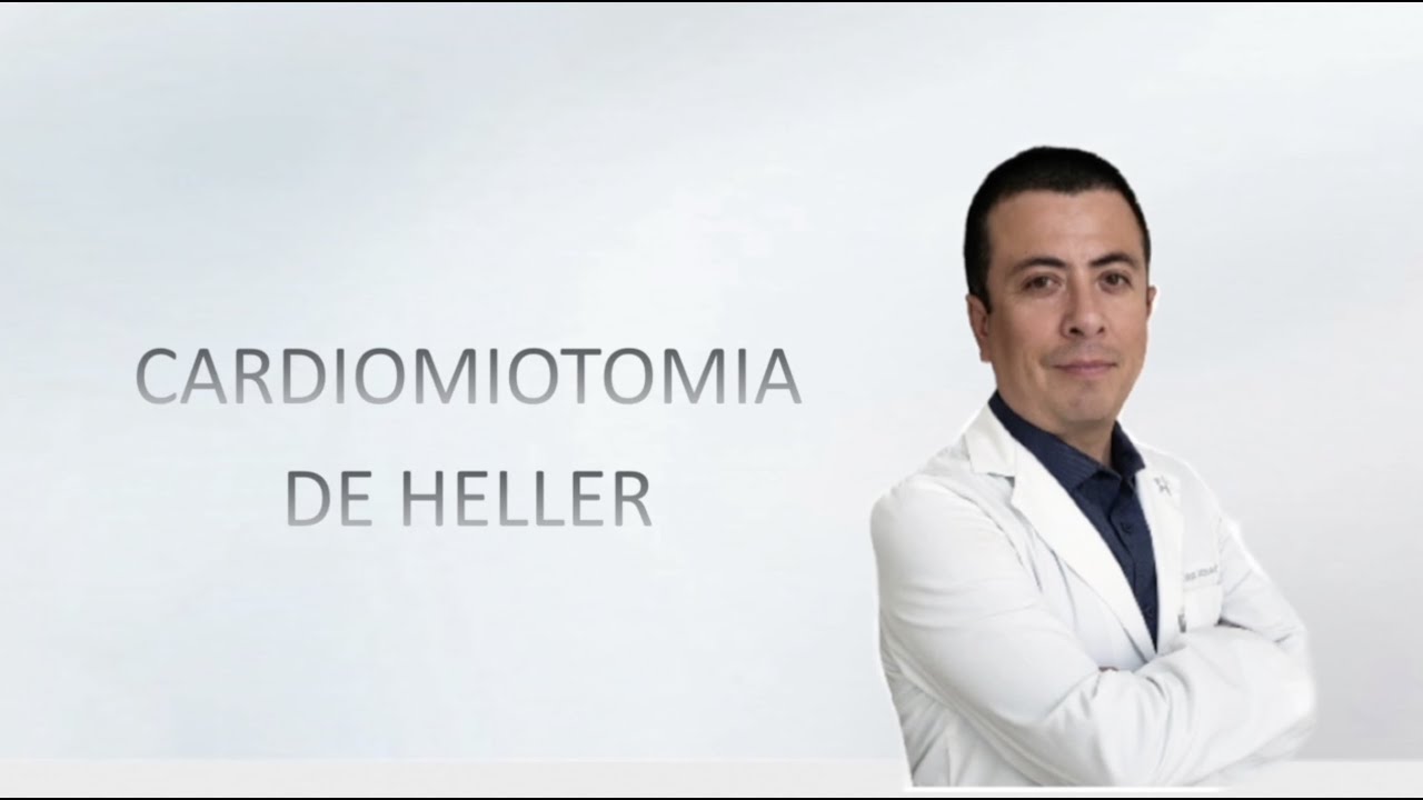 CARDIOMIOTOMIA DE HELLER- Dr. Edgar Villanueva - YouTube