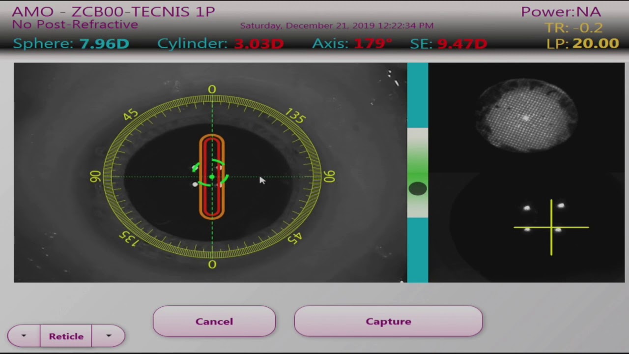 Optiwave Refractive Analysis (ORA) YouTube