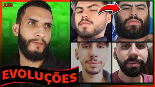 EVOLUÇÕES  COM MINOXIDIL (resultados dos inscritos) - 153
