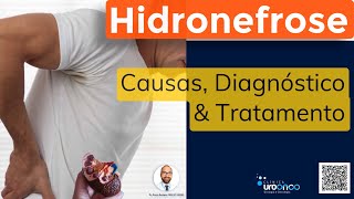 Hidronefrose (Rim Dilatado) | Como diagnosticar e tratar?