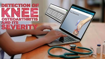 Online Knee Osteoarthritis Using Image Processing | Python Project
