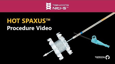 Niti-S™ HOT SPAXUS™ | Procedure Animation & Video