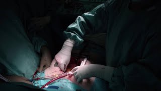 Eye tracking as a method to enhance surgical training