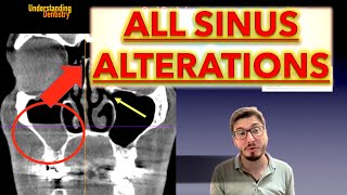 All Maxillary Sinus Pathologies Maxillary Sinusitis Surgery Lecture, Mucosal Thickening, Cbct