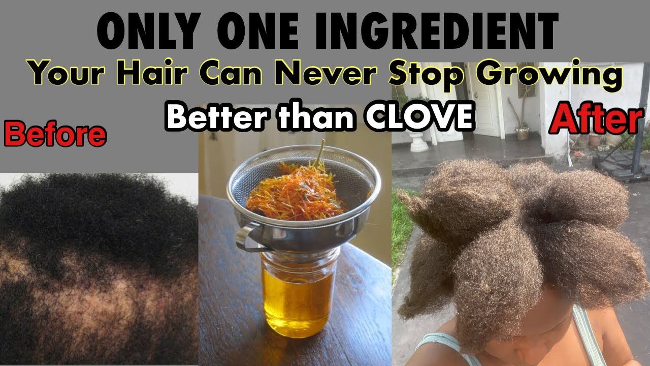 Clove didn’t grow your hair? Try this instead! How I Grew my hair