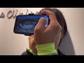 MeiboVue Smartphone Meibographer Handheld Operation