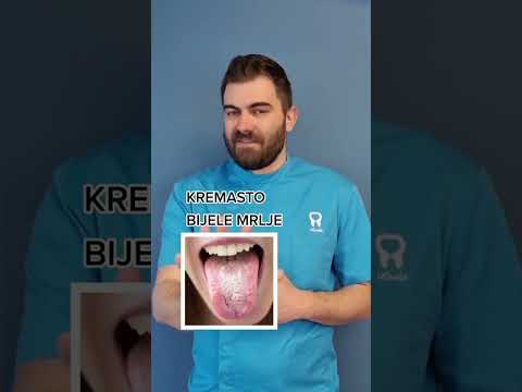Video: Šta znači žućkasto bijeli jezik?
