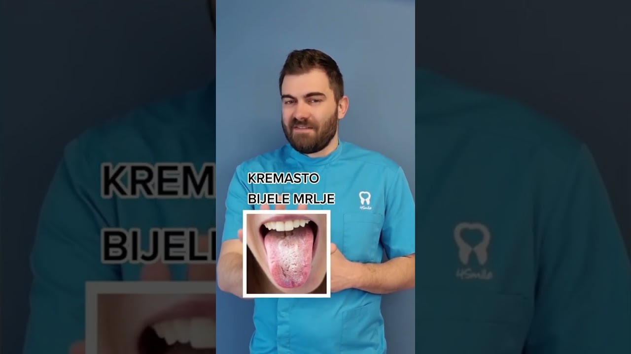 Što stomatolozi mogu znati gledajući vaš jezik?