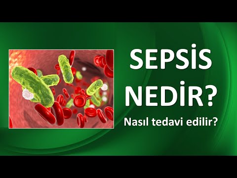 Video: Septik sistem nasıl test edilir?