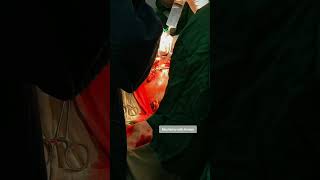 Surgery Days | OMF Surgery | Oral Cancer | Nursing Life | Surgeon Life