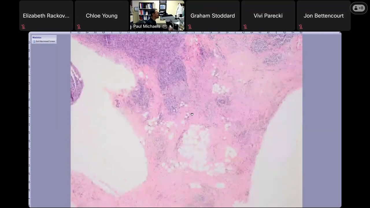Virtual Pathology Slide Session (2/13/26) with Dr. Paul Michaels