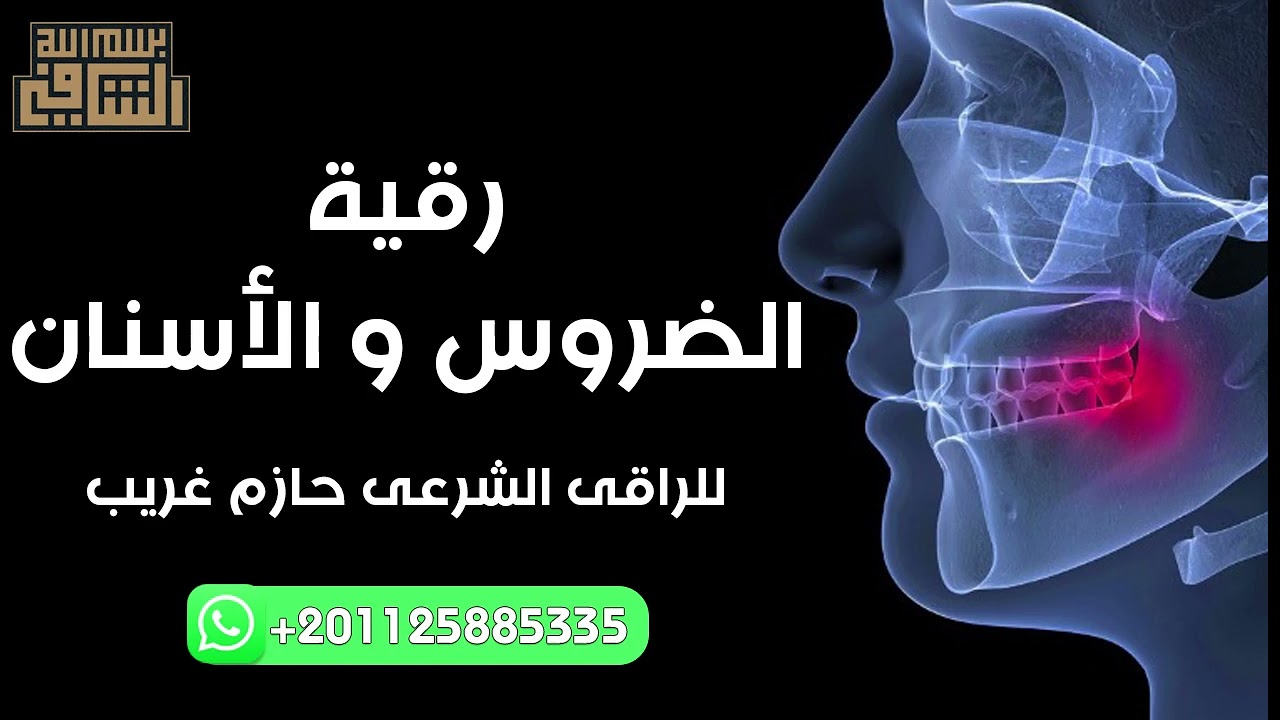 رقية الفم والاسنان | للراقى الشرعى حازم غريب