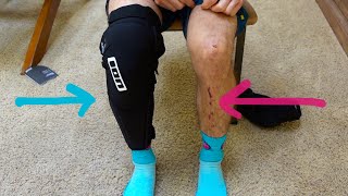 MTB KNEE PAD SHIN GUARD UNBOXING & REVIEW | ION K-PACT SELECT | Ep. 39