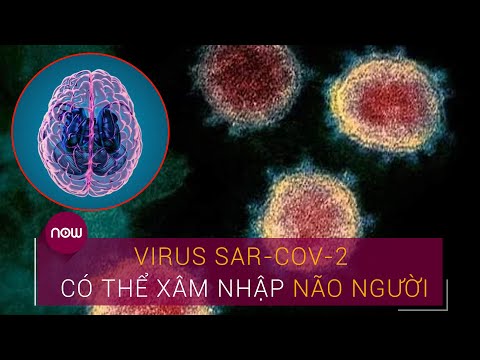 Virus SAR-CoV-2 có thể tấn công trực tiếp não người | VTC Now