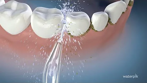 ¿Se debe usar Waterpik en implantes?