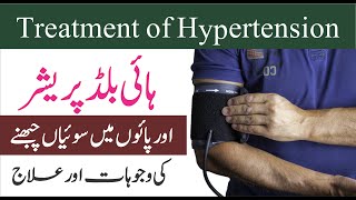 High Blood Pressure Ka Ilaj || ہائی بلڈ پریشر اور پائوں میں سوئیاں چبھنے کا علاج