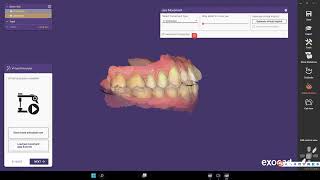 How to Export Jaw Motion and Design a Single Crown in Exocad