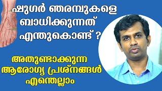 പ്രമേഹം എങ്ങനെ ശരീരത്തെ ബാധിക്കും | Diabetes Side Effects On Body | Malayalam Health Tips