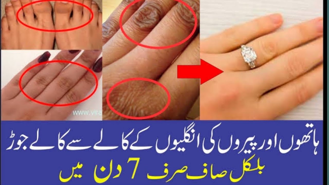 How to keep clean joints of hands and feets....?