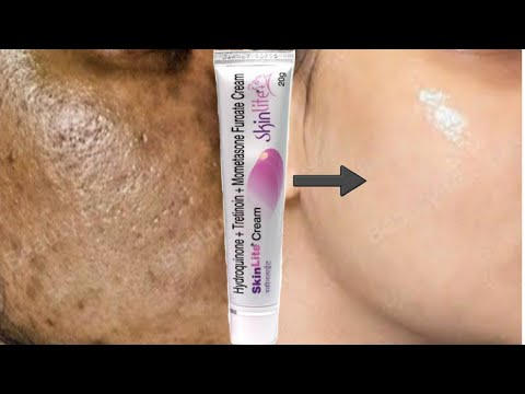 SkinLite Cream  | remove pigmentation |dark spots |Acne marks |pimple marks
