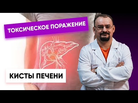 Токсическое поражение печени. Кисты печени