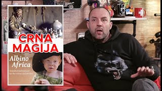 Zoran Marinović - Albinosi U Tanzaniji Žrtve Su Crne Magije