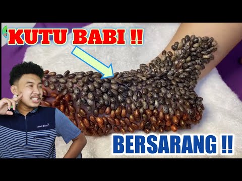 Video: 4 Penyakit Kutu Yang Menginfeksi Manusia Dan Hewan Peliharaan