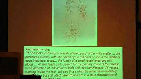 Dr. Dake Lecture Part 1 - Hubbard Foundation 2011 CCSVI Conference