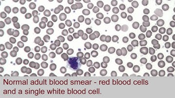 Automated Blood Analyser: Part 7 Blood Smear