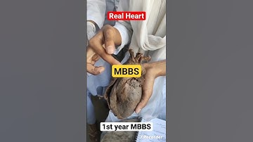 Real Heart Of Human Body Anatomy #mbbs #neet