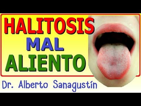 HALITOSIS (mal aliento) → causas, diagnóstico y tratamiento