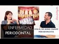 TODO SOBRE la Enfermedad Periodontal