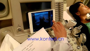 Wireless convex and linear array probes scanner from Medical Konted