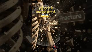 🦴 टूटी हुई हड्डी खुद कैसे जुड़ती है? 3D में देखे | Part 1| CardioNex Academy |