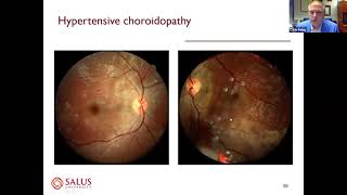 Identifying True Ocular Emergencies of the Posterior Pole