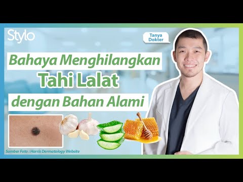 Menghilangkan Tahi Lalat dengan Bawang Putih, Madu & Lidah Buaya, Ampuh? Ini Kata Dokter! | Stylo.ID