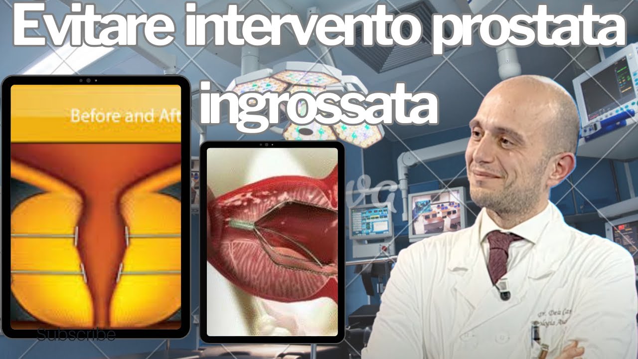 ''Retroeiaculazione'' post intervento? I nuovi trattamenti ambulatoriali per l iperplasia prostatica