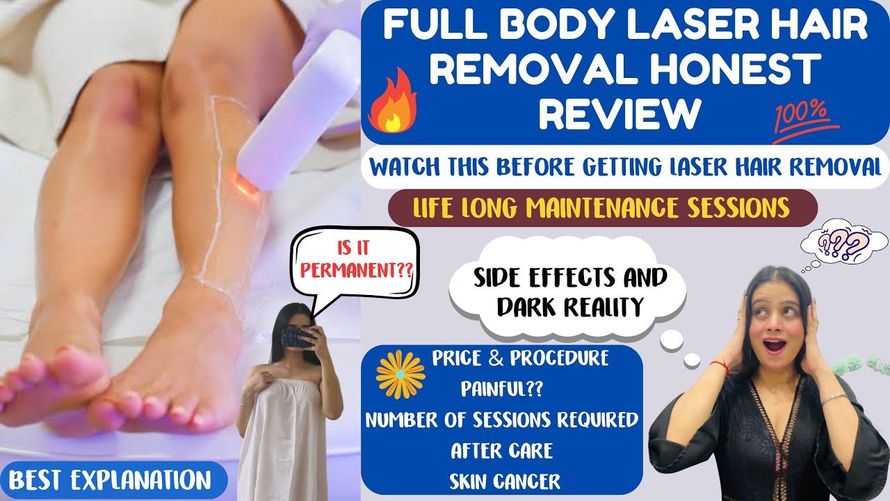 My Full Body Laser Hair Removal Experience Side Effects Price my-full-body-laser-hair-removal-experience-side-effects-price