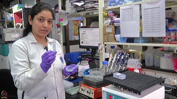 Lecture 20 : Screening of autoantibody signatures in cancer patients: Lab demonstration