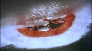 4.嫌気性菌をめぐる複数菌感染   ヨネプドダクシン