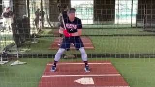 Josh Donaldson Separation Drill