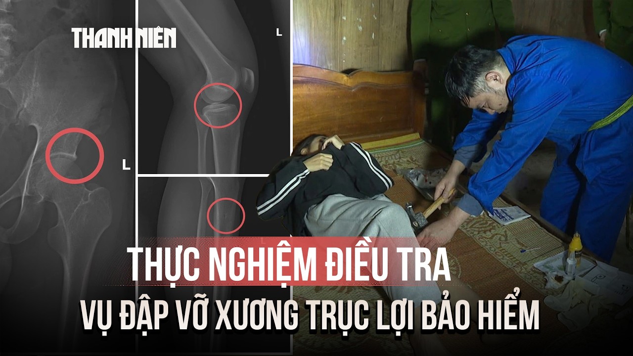 Công an thực nghiệm điều tra vụ tự đập vỡ xương để trục lợi bảo hiểm