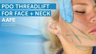Non-Surgical Face and Neck Lift with PDO Lifting Threads | AAFE