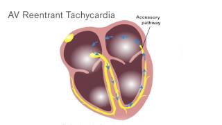 Clinical Education Series: Electrocardiogram - Full Video